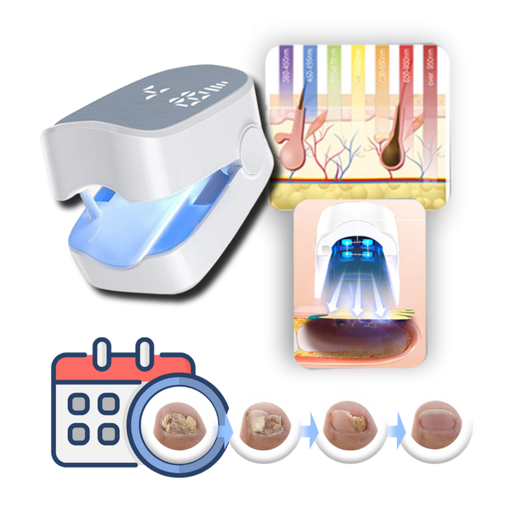 BowLift | Painless Nail Fungus Laser