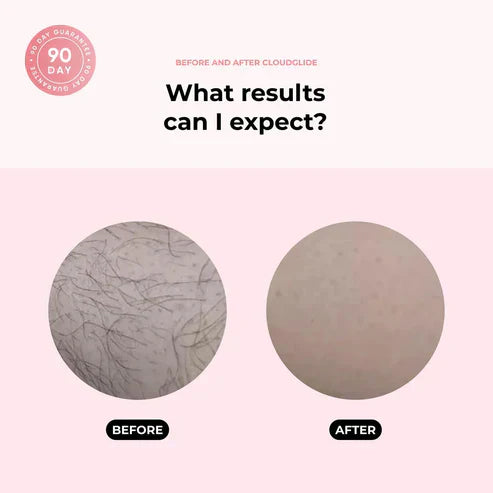 BowLift | SilkTrimmer | Soft skin in an instant