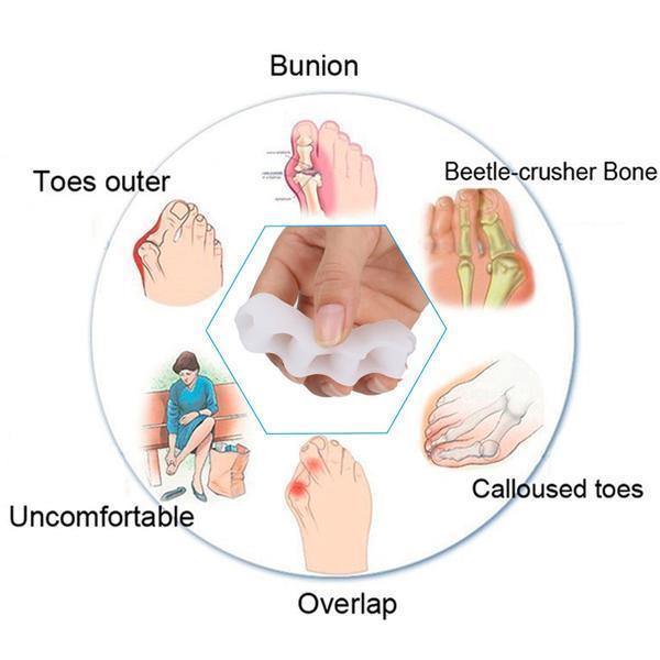 BowLift | Toe Recovery | Orthopedic Hallux and Hammer Toe Corrector with Toe Separator