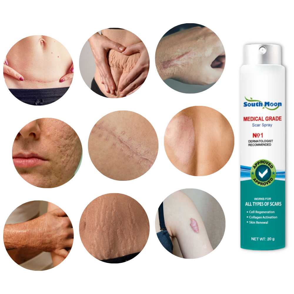 Spray treatment for scar removal