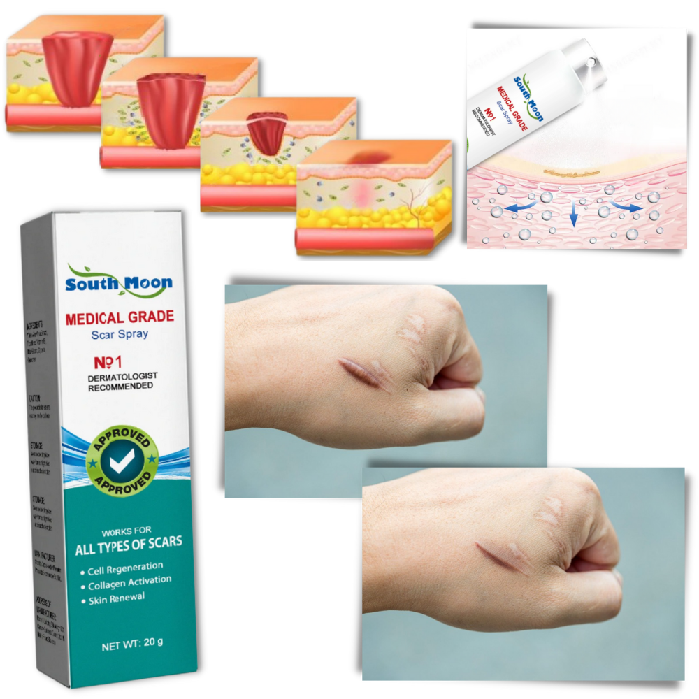 Spray treatment for scar removal