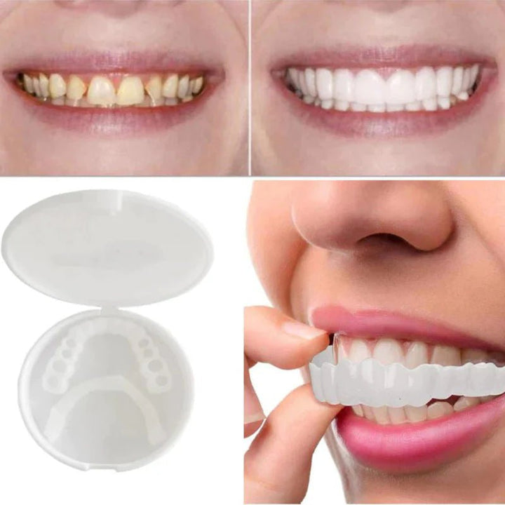 BowLift | SnapFit Dental Restoration – Perfect Smile Without Dentist Visits