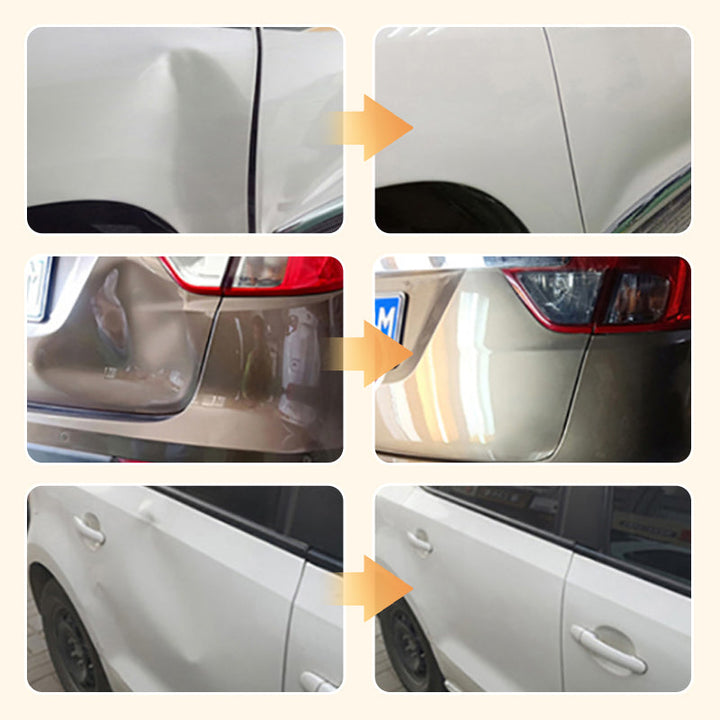BowLift | DentFix Perfect Surface Restore