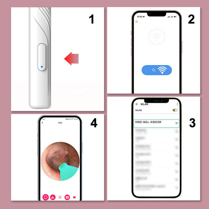 BowLift | Device for earwax removal with HD camera