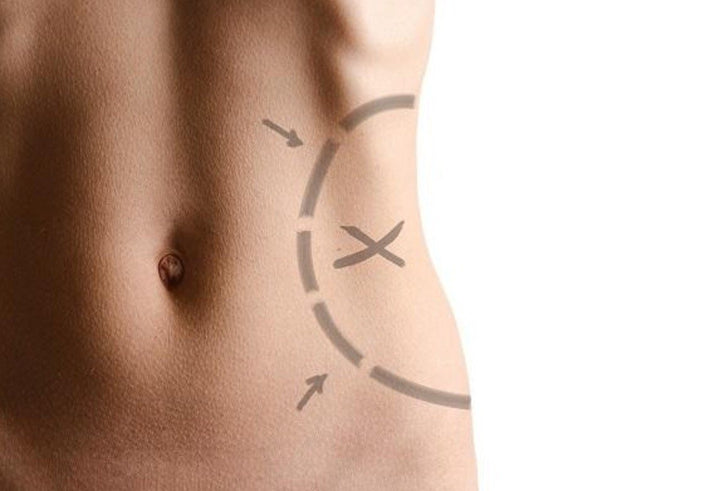 Ultrasound Slimming Device for Home Use | Bowlift